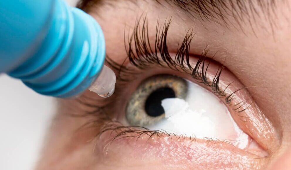 Kortikosteroid-Augentropfen bei Uveitis