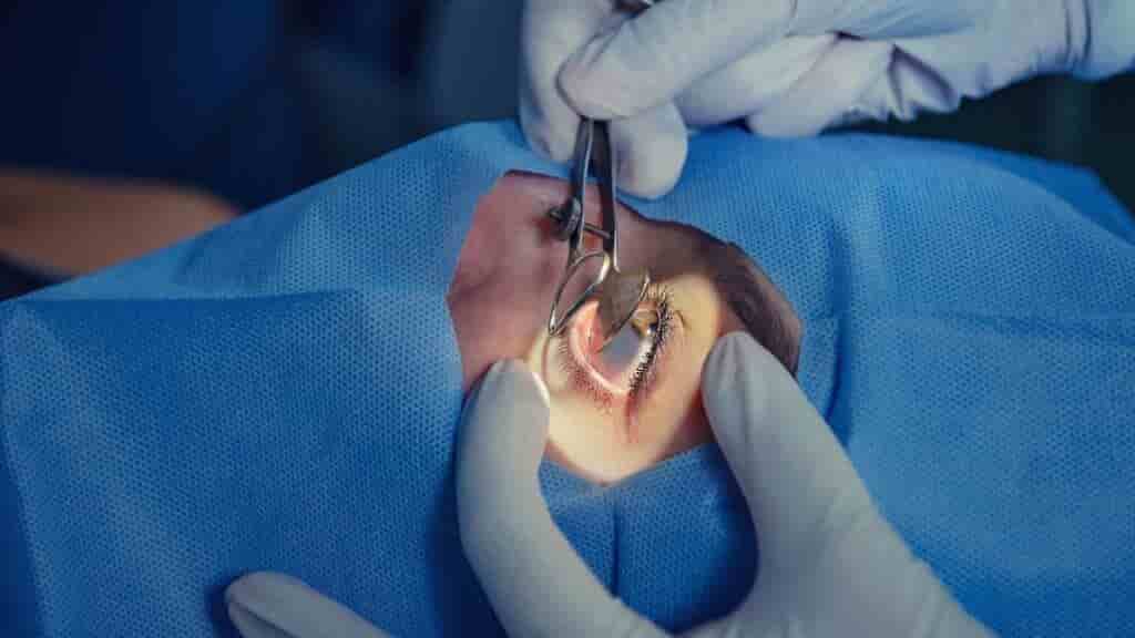 Chirurgie des geschwollenen Tränenkanals