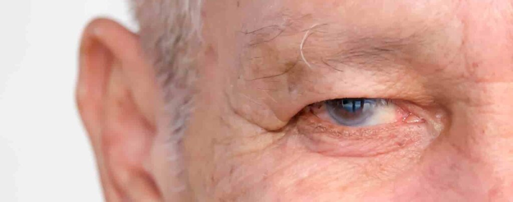 Makuladegeneration Neue Behandlung Rettet Augenlicht