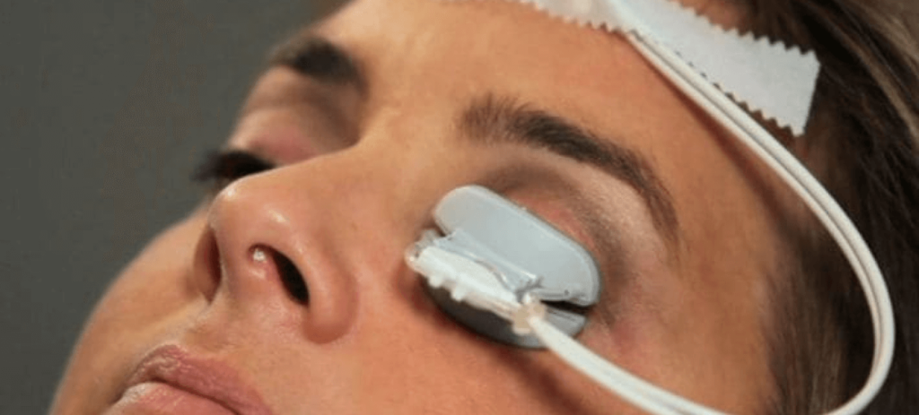 Lipiflow Behandlungen für trockene Augen
