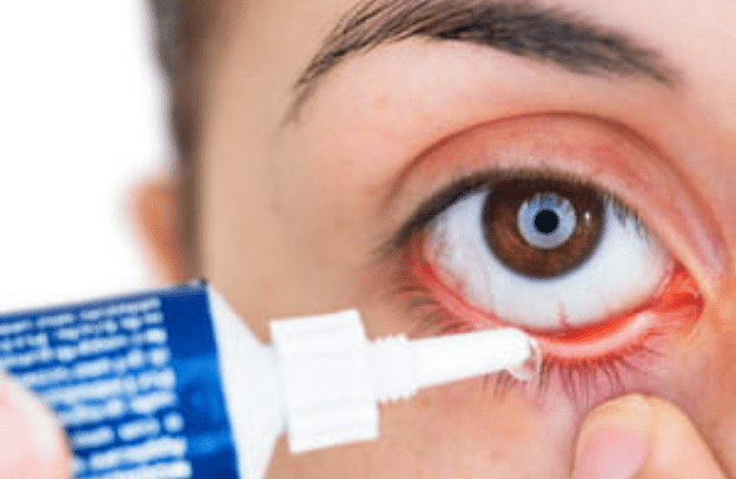 Salbe für Augeninfektionen